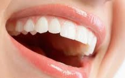 implant dentar Bucuresti