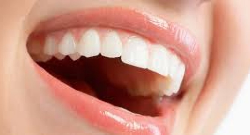 implant dentar Bucuresti