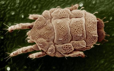 remedii naturale pentru paraziti intestinali