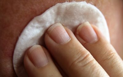 consultatia dermatologica